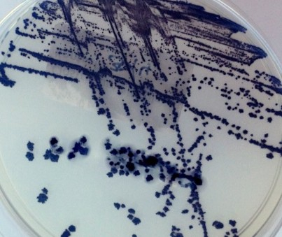 Infekce způsobené Clostridioides difficile: Prevence a role enterosorbentů