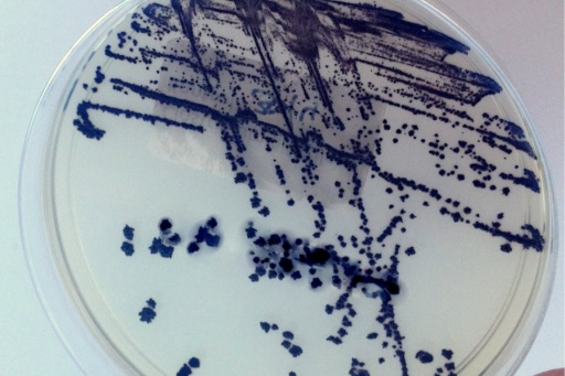 Clostridioides difficile Infections: Prevention and the role of enterosorbents