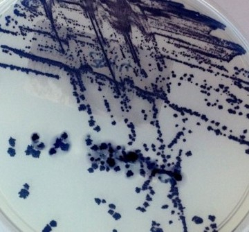 Infektionen durch Clostridioides difficile: Prävention und Rolle von Enterosorbenzien