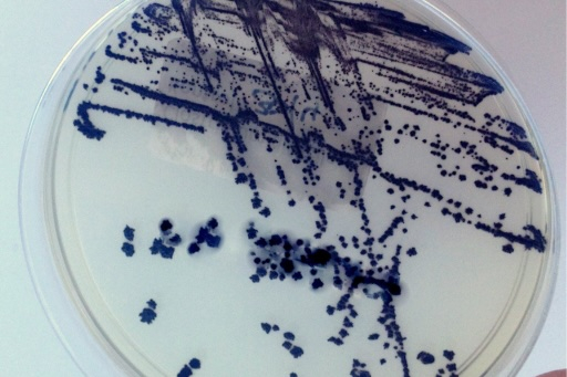Infekce způsobené Clostridioides difficile: Prevence a role enterosorbentů